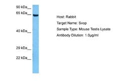 SVOP Rabbit anti-Mouse, Polyclonal, Novus Biologicals 0.1ml; Unconjugated:Antibodies,